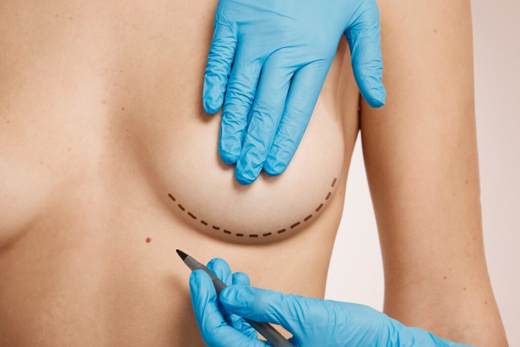 Alternatives naturelles et efficaces pour une augmentation mammaire sans prothèse