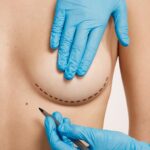 Alternatives naturelles et efficaces pour une augmentation mammaire sans prothèse