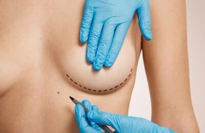 Alternatives naturelles et efficaces pour une augmentation mammaire sans prothèse