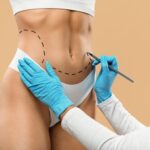 « Conseils Chirurgies » : Le guide de référence pour comprendre la chirurgie silhouette en Tunisie
