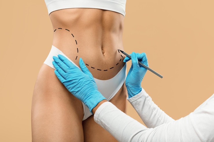 « Conseils Chirurgies » : Le guide de référence pour comprendre la chirurgie silhouette en Tunisie